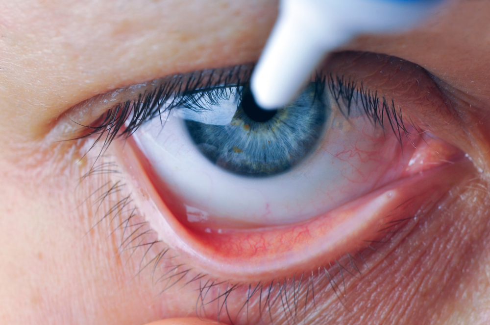 cách dùng thuốc nhỏ mắt tobradex