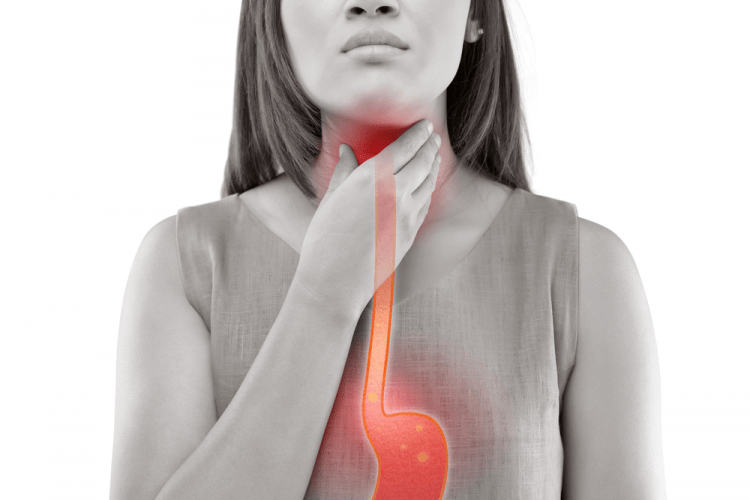 Trào ngược dạ dày thực quản gây đau rát cổ họng