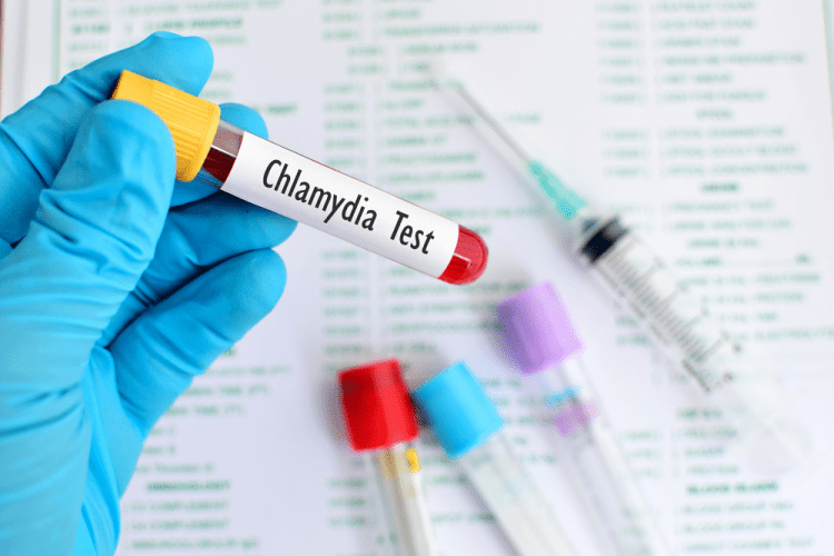 Vi khuẩn chlamydia trachomatis