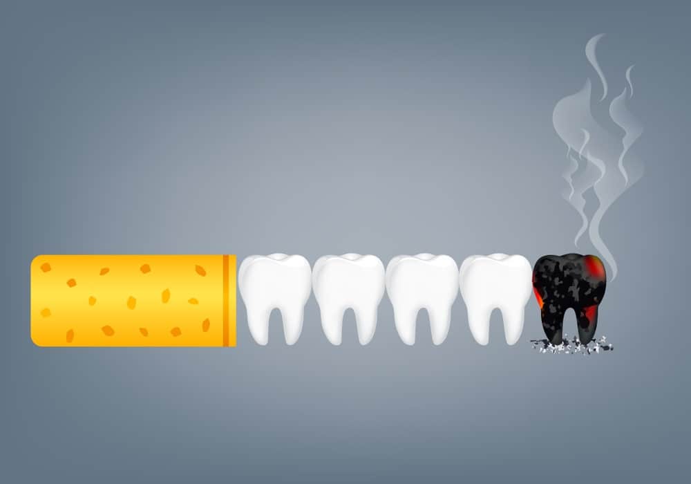 hút thuốc lá có hại cho răng miệng