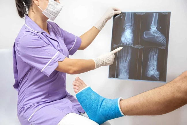Điều trị gãy xương: Bảo tồn hay phẫu thuật?