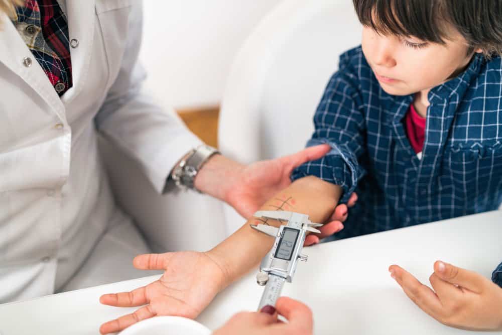 xét nghiệm da chẩn đoán dị ứng ở trẻ em