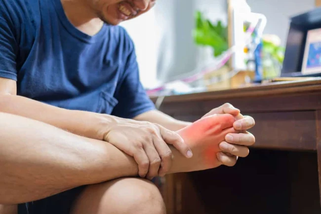 Bong gân bàn chân là gì? Nguyên nhân, triệu chứng và điều trị
