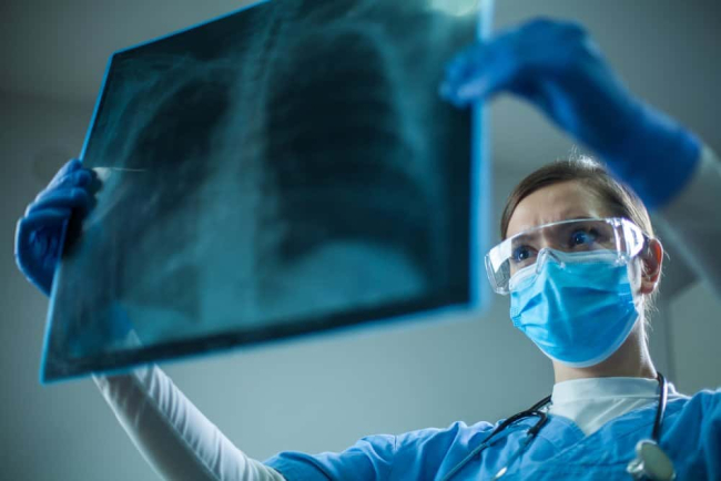 Nguyên nhân ung thư phổi là do đâu? Các yếu tố nguy cơ và cách phòng ngừa