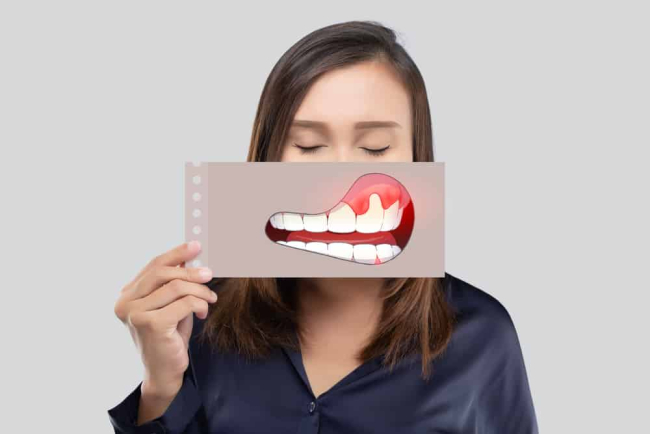 Truy tìm “thủ phạm” gây đau nướu răng và cách giảm đau hiệu quả
