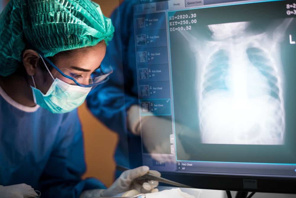xơ phổi có nguy hiểm không và cách điều trị