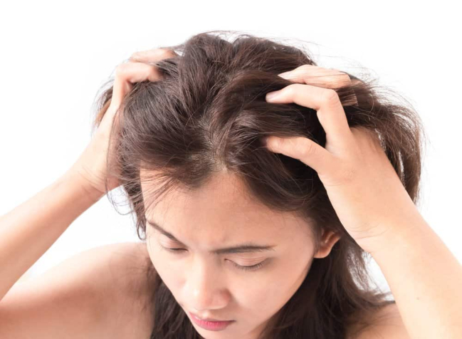 Bị gàu sau khi nhuộm tóc: Nguyên nhân và cách trị tại nhà