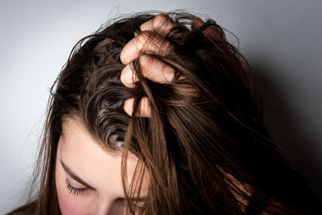 7 cách trị da đầu dầu giúp giảm nhờn, cho tóc suôn mượt bất chấp nắng nóng