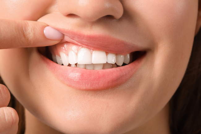 Túi nha chu là gì? Những thông tin cần biết để bảo vệ răng nướu tốt nhất