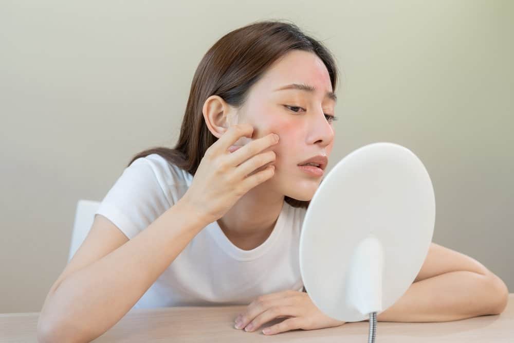 vitamin c có tác dụng gì với da mặt: giảm mẩn đỏ