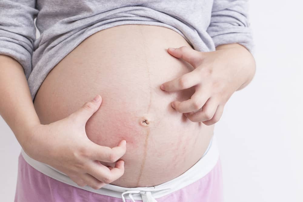 nguyên nhân sinh non: ứ mật thai kỳ
