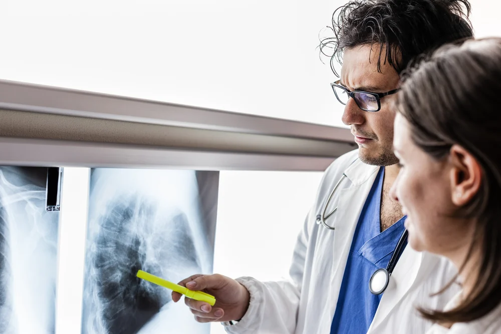 ung thư biểu mô tuyến phổi là gì
