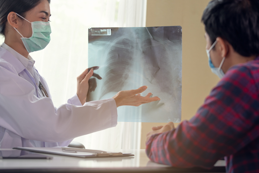 tràn dịch màng phổi có nguy hiểm không tùy thuộc vào điều trị